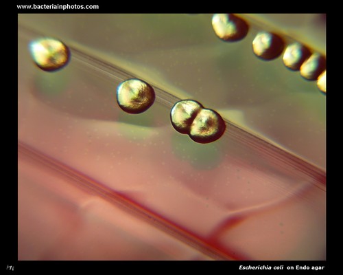 lactose fermentation on Endo with E.coli
